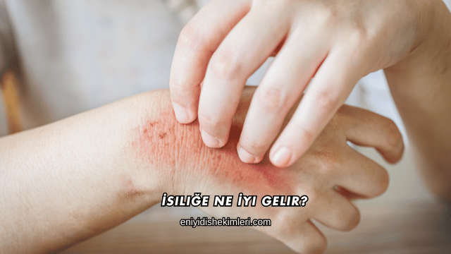 İsiliğe Ne İyi Gelir?