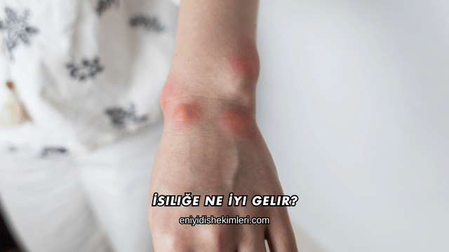 İsiliğe Ne İyi Gelir?