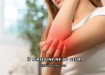 İt Dirseğine Ne İyi Gelir?