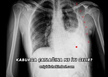 Kaburga Çatlağına Ne İyi Gelir?