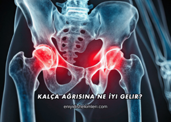 Kalça Ağrısına Ne İyi Gelir?