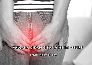Kalçada Çıkan Çıbana Ne İyi Gelir?