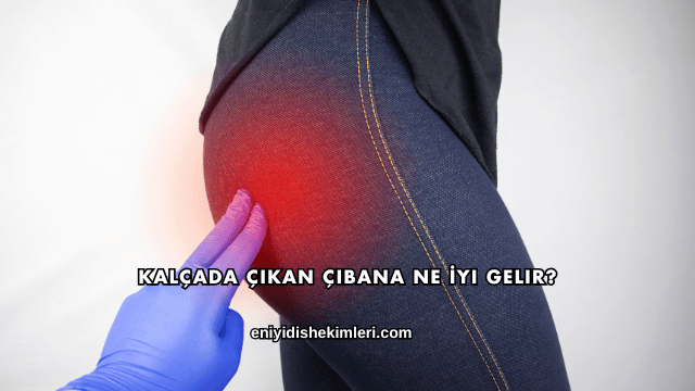 Kalçada Çıkan Çıbana Ne İyi Gelir?