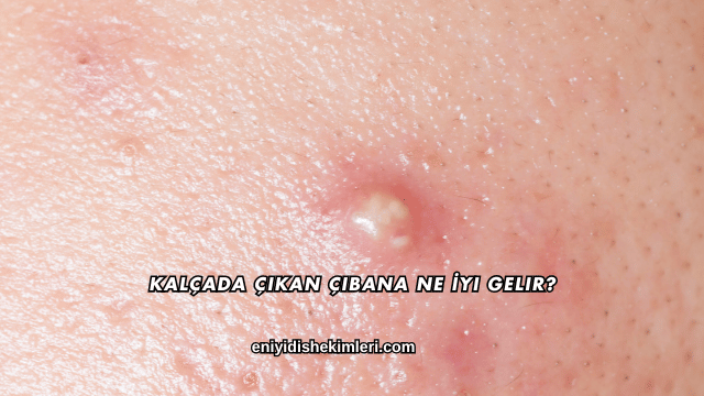 Kalçada Çıkan Çıbana Ne İyi Gelir?
