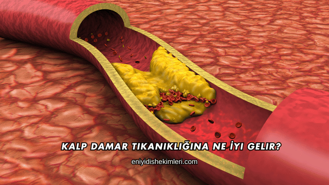Kalp Damar Tıkanıklığına Ne İyi Gelir