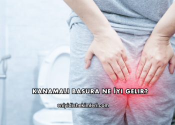 Kanamalı Basura Ne İyi Gelir?