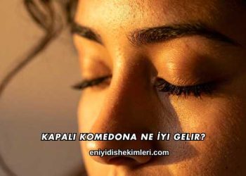 Kapalı Komedona Ne İyi Gelir?