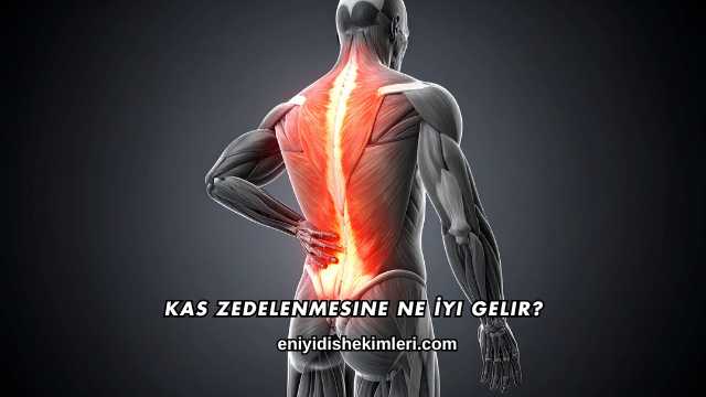 Kas Zedelenmesine Ne İyi Gelir?