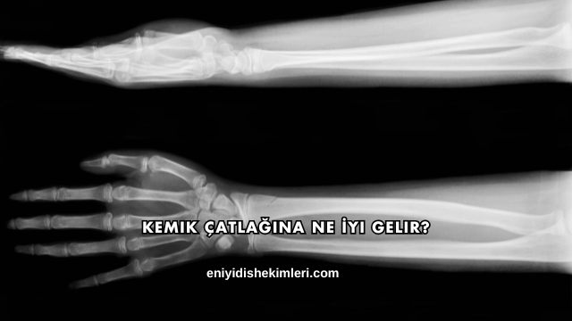 Kemik Çatlağına Ne İyi Gelir?