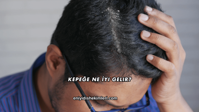 Kepeğe Ne İyi Gelir?