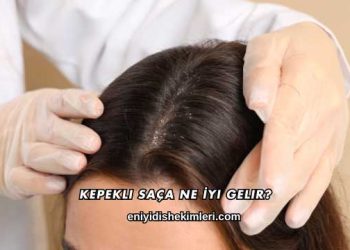 Kepekli Saça Ne İyi Gelir?