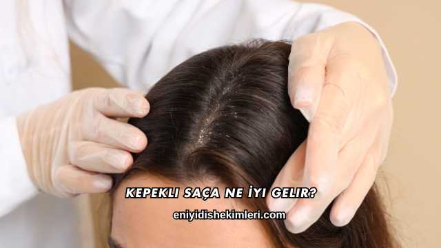 Kepekli Saça Ne İyi Gelir?