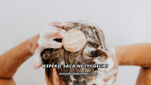 Kepekli Saça Ne İyi Gelir?