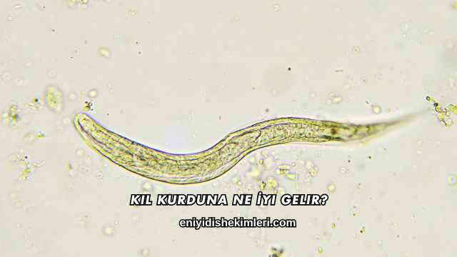 Kıl Kurduna Ne İyi Gelir?