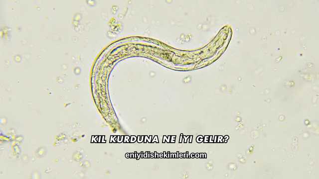 Kıl Kurduna Ne İyi Gelir?