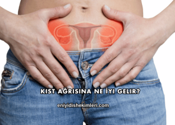 Kist Ağrısına Ne İyi Gelir?
