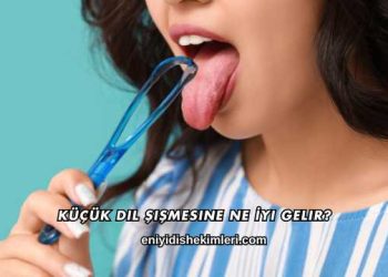 Küçük Dil Şişmesine Ne İyi Gelir?