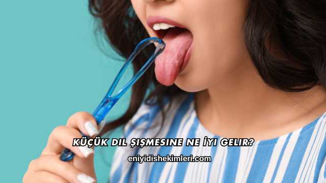 Küçük Dil Şişmesine Ne İyi Gelir?