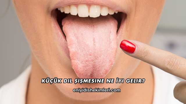 Küçük Dil Şişmesine Ne İyi Gelir?