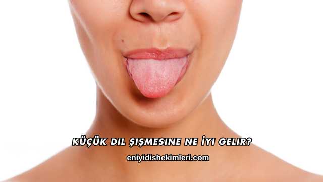Küçük Dil Şişmesine Ne İyi Gelir?