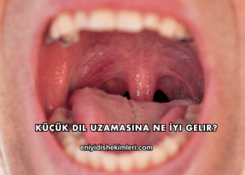 Küçük Dil Uzamasına Ne İyi Gelir?