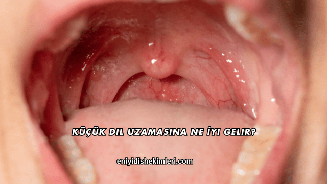 Küçük Dil Uzamasına Ne İyi Gelir?