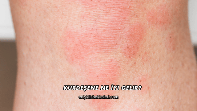 Kurdeşene Ne İyi Gelir?