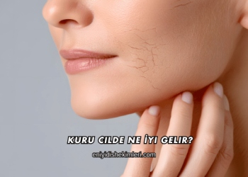 Kuru Cilde Ne İyi Gelir?