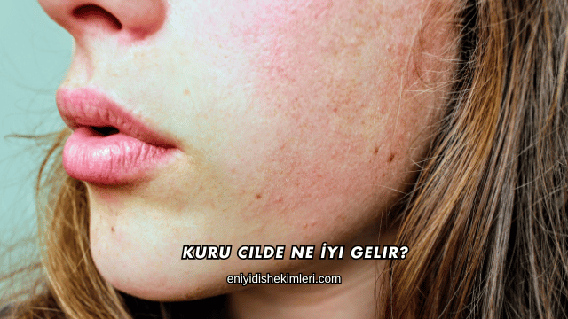 Kuru Cilde Ne İyi Gelir?