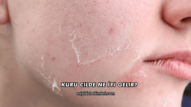 Kuru Cilde Ne İyi Gelir?