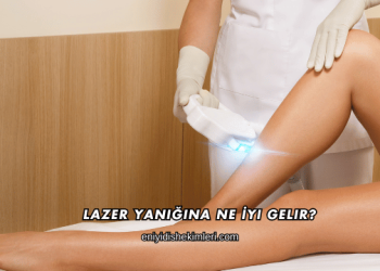 Lazer Yanığına Ne İyi Gelir?