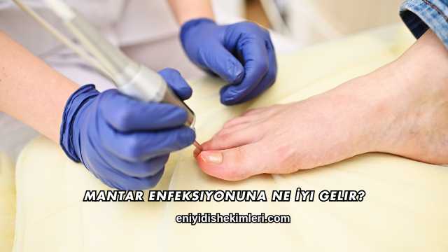 Mantar Enfeksiyonuna Ne İyi Gelir?
