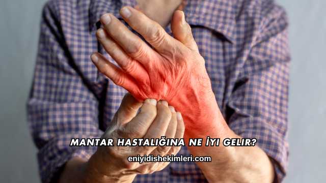 Mantar Hastalığına Ne İyi Gelir?