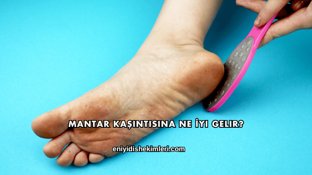 Mantar Kaşıntısına Ne İyi Gelir?
