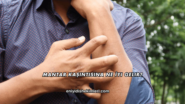 Mantar Kaşıntısına Ne İyi Gelir?