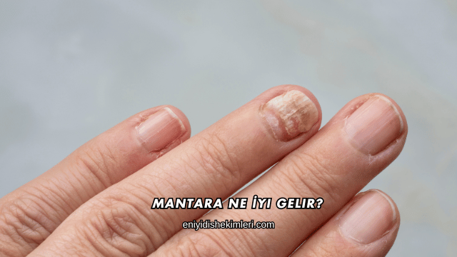 Mantara Ne İyi Gelir?