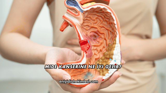 Mide Kanserine Ne İyi Gelir?