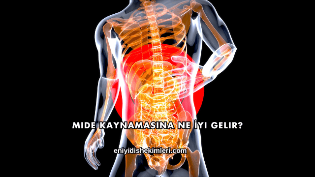 Mide Kaynamasına Ne İyi Gelir?