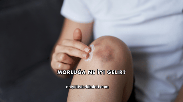 Morluğa Ne İyi Gelir?