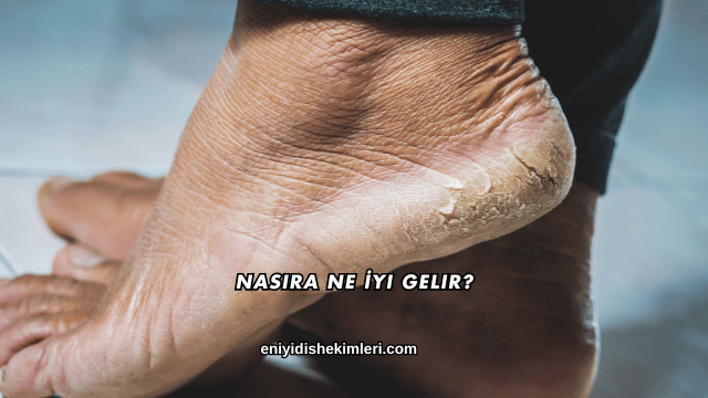 Nasıra Ne İyi Gelir?