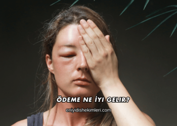 Ödeme Ne İyi Gelir?