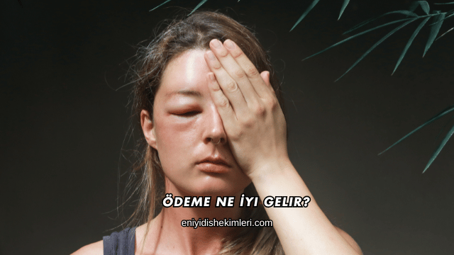 Ödeme Ne İyi Gelir?