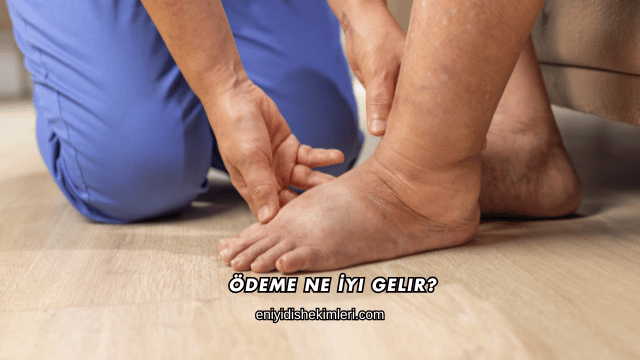 Ödeme Ne İyi Gelir?