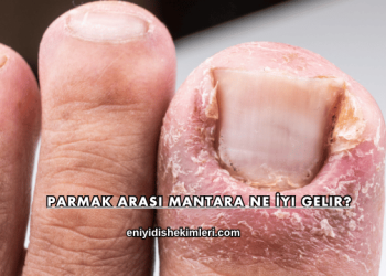 Parmak Arası Mantara Ne İyi Gelir?