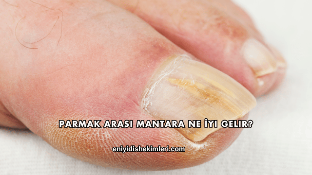 Parmak Arası Mantara Ne İyi Gelir?