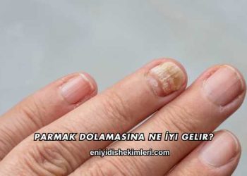Parmak Dolamasına Ne İyi Gelir?