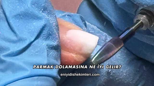 Parmak Dolamasına Ne İyi Gelir?