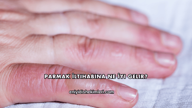 Parmak İltihabına Ne İyi Gelir?