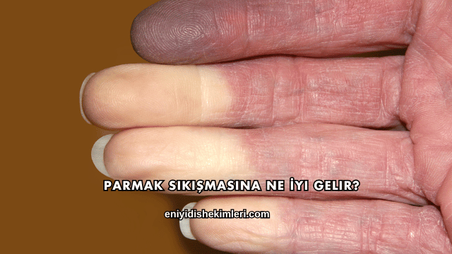 Parmak Sıkışmasına Ne İyi Gelir?