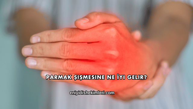 Parmak Şişmesine Ne İyi Gelir?